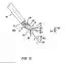 Fig. 06 - Autofocus and/or autoscaling in telesurgery