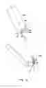 Fig. 09 - Autofocus and/or autoscaling in telesurgery