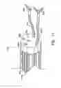 Fig. 15 - Autofocus and/or autoscaling in telesurgery