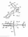 Fig. 04 - ANOSCOPE