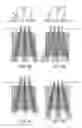 Fig. 05 - Systems and methods for lensed and lensless optical sensing