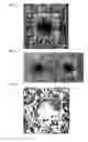 Fig. 06 - Ophthalmic analysis device and ophthalmic analysis program