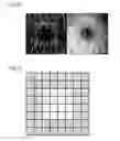 Fig. 08 - Ophthalmic analysis device and ophthalmic analysis program