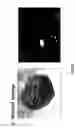 Fig. 10 - Method for simultaneously detecting fluorescence and raman signals for multiple fluorescence and raman signal targets, and medical imaging device for simultaneously detecting multiple targets using the method