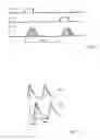 Fig. 03 - Method for determining blood pressure in a blood vessel and device for carrying out said method
