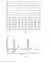 Fig. 02 - Automatic method to delineate or categorize an electrocardiogram