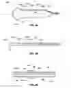 Fig. 07 - High density electrode mapping catheter