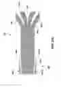 Fig. 43 - High density electrode mapping catheter