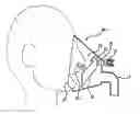 Fig. 01 - Airway adaptor