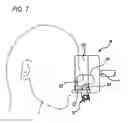 Fig. 08 - Airway adaptor