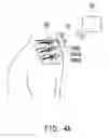 Fig. 07 - Sensing bone fixing element