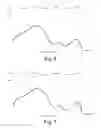 Fig. 07 - Measurement of Hydration, Edema, and Bioelectrical Impedance