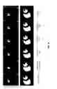 Fig. 05 - Systems and methods for reducing respiratory-induced motion artifacts for accelerated imaging