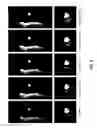 Fig. 07 - Systems and methods for reducing respiratory-induced motion artifacts for accelerated imaging