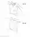 Fig. 06 - METHOD AND APPARATUS FOR DETECTING A BIOLOGICAL CONDITION FROM A COMPARATIVE MEASUREMENT