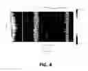Fig. 05 - Informatics radiomics integration system (IRIS): a novel combined informatics and radiomics method for integration of many types of data for classification into different groups for improved visualization