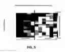 Fig. 06 - Informatics radiomics integration system (IRIS): a novel combined informatics and radiomics method for integration of many types of data for classification into different groups for improved visualization