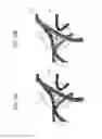 Fig. 13 - Imaging diagnosis apparatus having needling navigation control system and a needling navigation controlling method