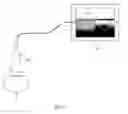 Fig. 06 - Method and apparatus for real-time and robust strain imaging