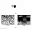 Fig. 07 - Method and apparatus for real-time and robust strain imaging