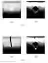Fig. 08 - Method and apparatus for real-time and robust strain imaging