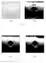 Fig. 09 - Method and apparatus for real-time and robust strain imaging