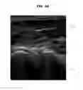 Fig. 05 - Ultrasound imaging apparatus and method of controlling the same