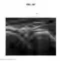 Fig. 08 - Ultrasound imaging apparatus and method of controlling the same