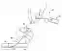 Fig. 01 - EXPANDABLE DEVICE SHEATH FOR VASCULAR CLOSURE PLUG DEPLOYMENT