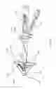Fig. 07 - Laparoscopic fascial closure system