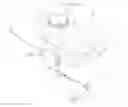 Fig. 01 - Surgical traction apparatus