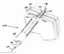 Fig. 01 - Slitted tissue fixation devices and assemblies for deploying the same