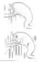 Fig. 02 - Slitted tissue fixation devices and assemblies for deploying the same