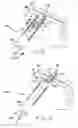 Fig. 04 - Slitted tissue fixation devices and assemblies for deploying the same