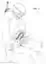 Fig. 04 - Tourniquet and methods of use and construction thereof