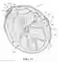 Fig. 08 - Tourniquet and methods of use and construction thereof