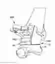 Fig. 01 - System and method for anterior approach for installing tibial stem