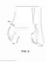 Fig. 09 - System and method for anterior approach for installing tibial stem