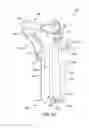 Fig. 49 - System and method for anterior approach for installing tibial stem