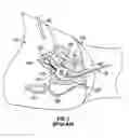 Fig. 02 - Uterine manipulator