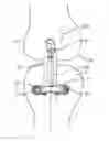 Fig. 01 - Implantable assembly for a knee joint and method for mounting an implantable assembly for a knee joint