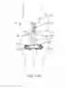 Fig. 07 - Implantable assembly for a knee joint and method for mounting an implantable assembly for a knee joint