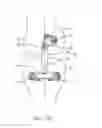 Fig. 08 - Implantable assembly for a knee joint and method for mounting an implantable assembly for a knee joint