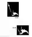 Fig. 08 - Spondylolisthesis reduction system