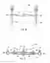 Fig. 07 - Pedicle screw