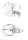 Fig. 03 - Occipital plate systems