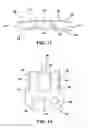 Fig. 07 - Static compression device