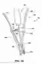 Fig. 15 - Static compression device