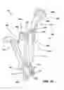 Fig. 17 - Static compression device