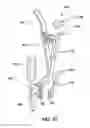 Fig. 20 - Static compression device